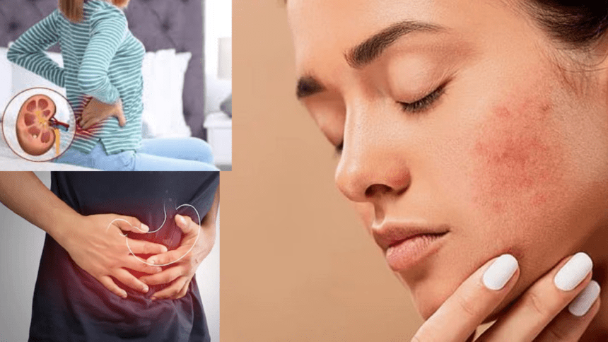Before Taking a Supplement Know Its Side Effects