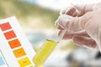 Identify Symptoms of This Disease Through Urine