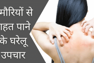 These 10 home remedies will help you get rid of rashes