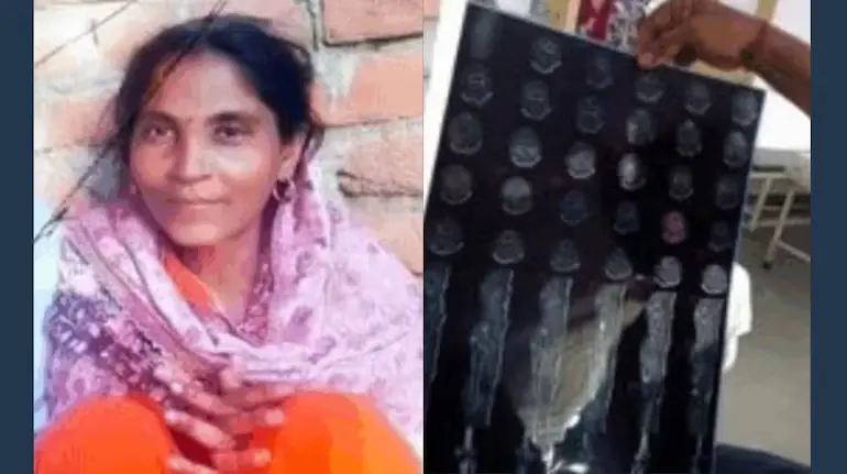 panipat-hospital-negligence-woman-heart-stent-without-consent-fracture-treatment-death
