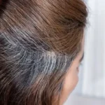 white-hair-and-cancer-japanese-research-hindi