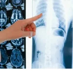 ai-fake-fracture-report-doctor-caught-error-before-surgery-healthcare-ai-debate