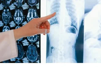 ai-fake-fracture-report-doctor-caught-error-before-surgery-healthcare-ai-debate