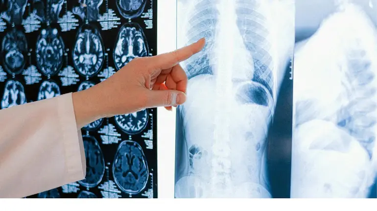 ai-fake-fracture-report-doctor-caught-error-before-surgery-healthcare-ai-debate