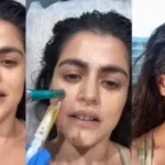 vampire-facial-apna-khoon-chehre-par-fayde-process-cost