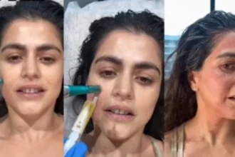 vampire-facial-apna-khoon-chehre-par-fayde-process-cost